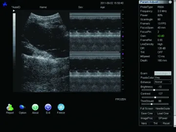 WED-160 Full Digital Ultrasound System