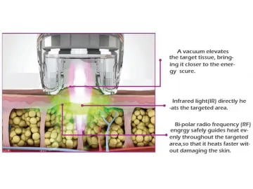 Infrared RF(Radio -frequency)