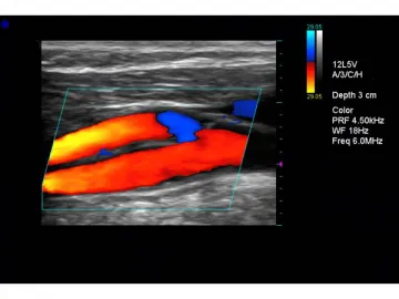 ﻿﻿FDC6000 Color Doppler Ultrasound System